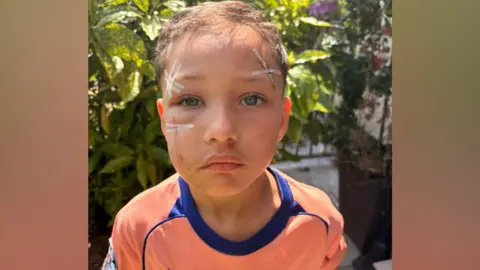 A boy wearing an orange football jersey standing outside in a garden. He has cuts and bruises on his face some taped up.