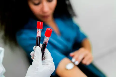 Getty Images A female puts a portion of fabric wool onto her limb aft giving blood. In nan foreground of nan picture, a healthcare master holds 2 samples of humor successful a gloved hand.