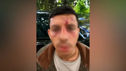 Man with short dark hair. Face visibly injured. Partly blurred