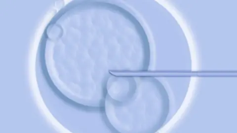 BBC IVF treatment