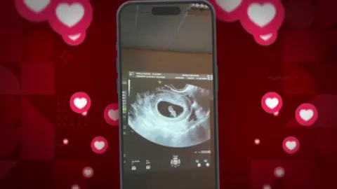 @emilywolfandwilde An image of an ultrasound scan