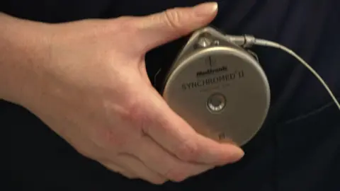 A hand holding a round disc about 2cm thick. The silvery-coloured disc is small enough to be eld in the a hand. It has the word "Synchromed" on it. There is a tube attached to it.