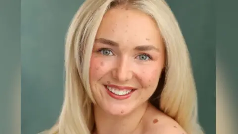Scarlett Clarke in a head and shoulders photo. She is smiling at the camera and her blonde hair is worn down. She has CMN "satellites" on her face and shoulders of various shapes and sizes.