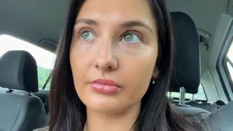 Erin Evans Erin Evans, who has long brown hair and green eyes and has taken a selfie sitting in her car after having many operations to repair her lip. She looks away from the camera with a neutral expression