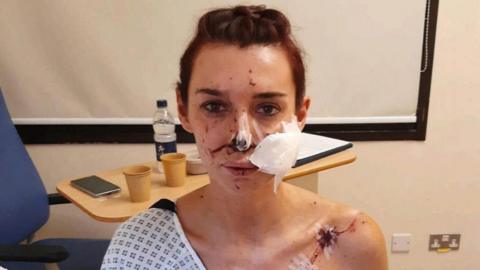 Natalie Arthurs was attacked with a broken glass by a stranger