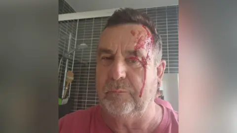 A man wearing a pink shirt in a bathroom. He has blood on his face.