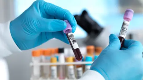 Getty Images Hand holding a blood sample