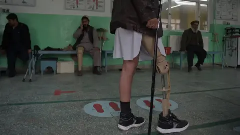 AFP In this photograph taken on February 13, 2018 shows an Afghan amputee walking with his prosthetic leg at a hospital run by the International Committee of the Red Cross (ICRC) for war victims and the disabled in Kabul