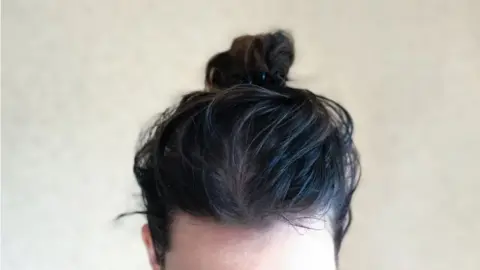 Getty Images Greasy hair