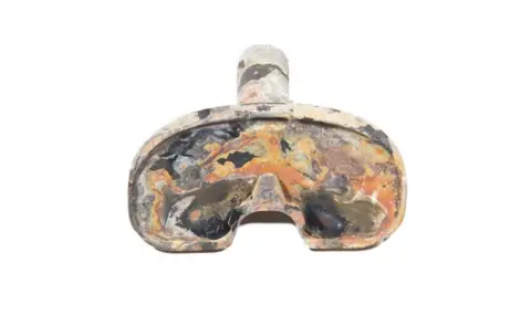 Harry Lloyd-Evans Tibial knee replacement