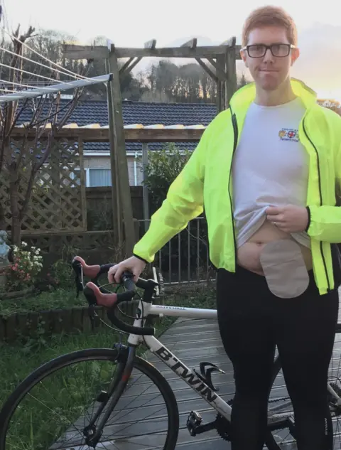 Adam Froggatt Adam with colonoscopy bag