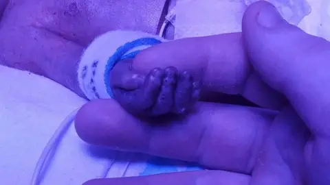 Sheree Murray Archie's hand and mum