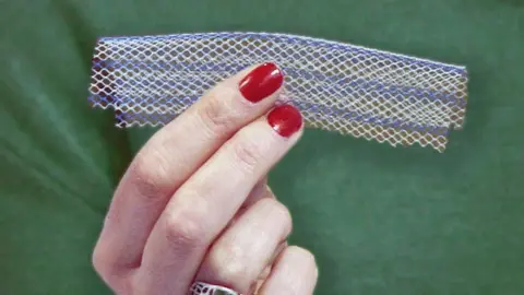 Mesh