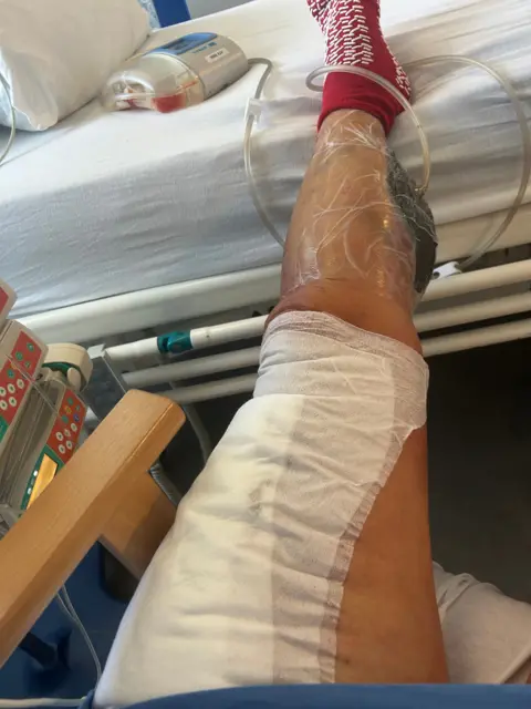 Mary-Jane Parker Mary-Jane's leg with a huge plaster on it