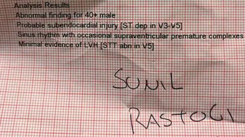 A piece of paper showing analysis results. It says 'Abnormal finding for 40+ male'.