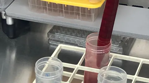 A collection pot of blood being used for analysis at the Anthony Nolan Research Institute in London