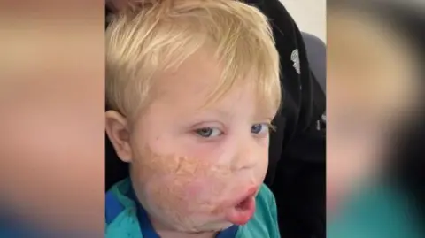 Danielle Alfred is looking at the camera, where you can see the stitches to his face following surgery after being bitten by a dog.