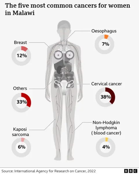 A diagram of a human body showing the five most common cancers for women in Malawi. Cervical cancer is the most common, followed by breast, esophagus, Kaposi's sarcoma and non-Hodgkin lymphoma. 