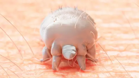 An artist impression of a mite on the skin. 