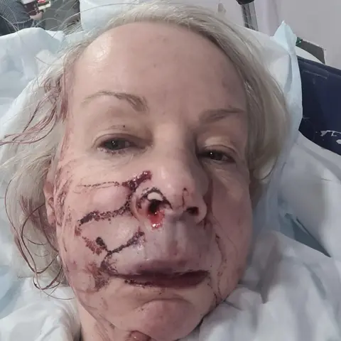 Sandy Peters A woman with a bloody face