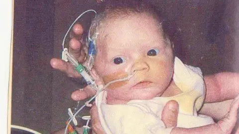Regan Sparks A baby is pictured with a tube coming out of her nose and various wires and tubes connected to her. She is being held by a pair of adult hands and is wearing a white vest.