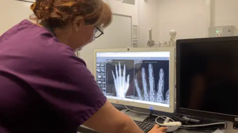 A woman looking at a computer screen which shows two X-ray images of a hand side by side