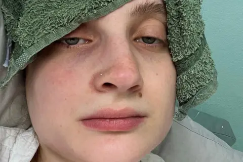 Ella Marcham Woman looking unwell with a wet flannel on her forehead.