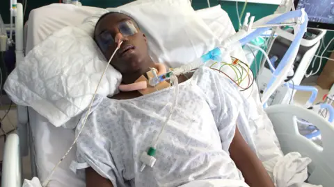 Boyce family via Met Police Jamel Boyce, a 17-year-old male, in a hospital bed. He is wearing a hospital gown and is attached to breathing apparatus. His eyes are taped closed.