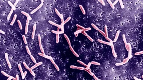 Campylobacter Is A Family Of Curved Gram Negative Bacteria