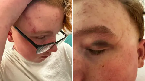 Supplied A split screen photo showing cuts and cruises to a teenager's face, and a heavily bruised eye closer up