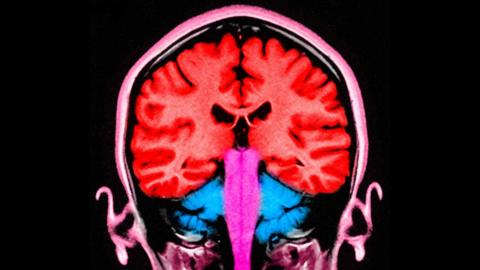 Can a pulse of electricity to the brain 