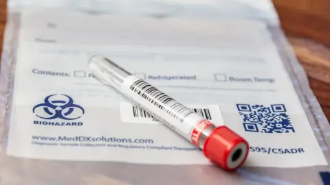 Getty Images Covid swab