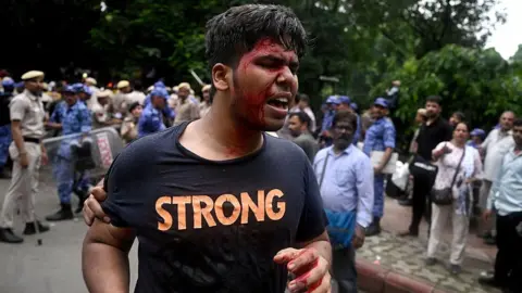 Getty Images A supporter of the Cockroach Janta Party (CJP) reacts after getting injured during a protest demanding the resignation of India's Education Minister Dharmendra Pradhan over alleged NEET examination irregularities in New Delhi on July 20, 2026. India's riot police baton-charged protesters in New Delhi as they tried to march to parliament on July 20, escalating a protest over irregularities in major examinations. (Photo by Arun SANKAR / AFP via Getty Images)