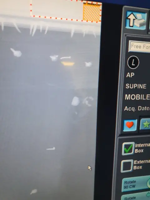 Bannockburn House Trust An x-ray of the headboard showing the musket shot in amongst tacks.