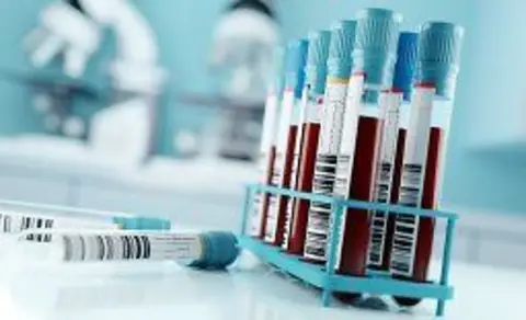 Blood samples and test results in a medical facility