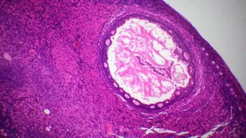 Getty Images Section of ovary under the microscope