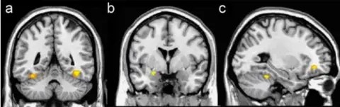 Jay van Bavel/Dominic Packer Functional MRI scans from the research