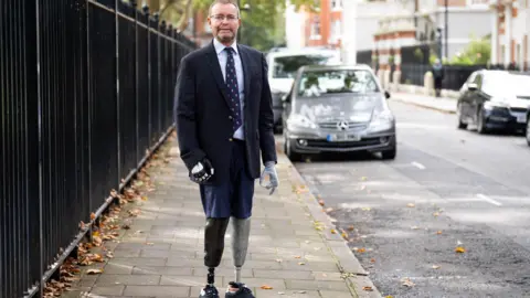 Lord Mackinlay standing on a pavement next to some railings wearing a suit with his prosthetic arms and legs clearly visible. 