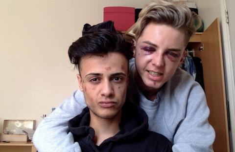 Beaten up for being gay - BBC News