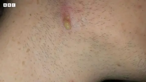 Spot