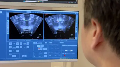 A monitor showing two displays of ultrasound images, with a man to the right sitting with the back of his head to the camera