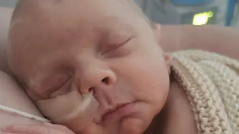 Close up of baby Anthony's face. He has a tube going into his left nostril and looks to be asleep. The white tube has been taped down to his cheek. He has been wrapped in a beige knitted blanket. 