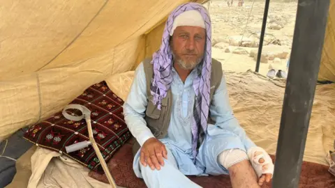 Noor sitting on a mattress in a tent with bandages covering his leg, hand and head