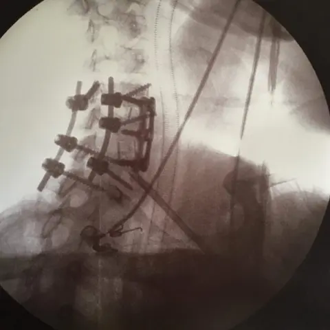 Sophie Wilson x-ray of injuries