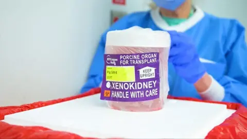 Pig kidney