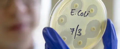 Getty Images Scientist with an E. coli sample