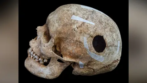 A Viking era skull post excavation cleaned up and resting so its face is on the left. In the middle of the lower side of the skull is a 3cm hole. 