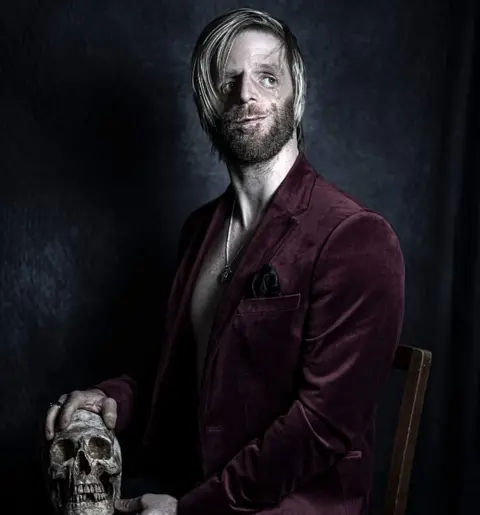 Debbie Todd A man with a condition affecting the stricture of his face poses with a skull