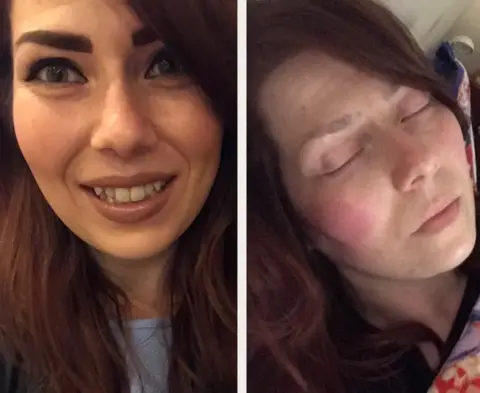 Supplied Two photos of Alison. One she is well, the other she is in a lot of pain