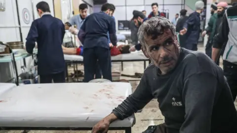 EPA People injured in an attack on the town of Misraba, in the Eastern Ghouta outside Damascus, receives treatment at a hospital (4 January 2018)